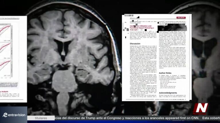 Parkinson: Nuevo Modelo Predice Primeras Caídas Y Ofrece Soluciones